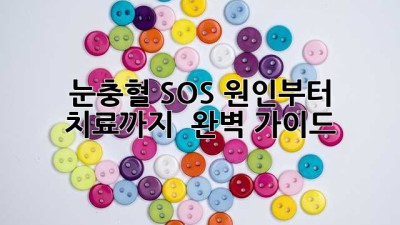 🚨 눈충혈 SOS🚨 원인부터 치료까지! 👀✨ 완벽 가이드